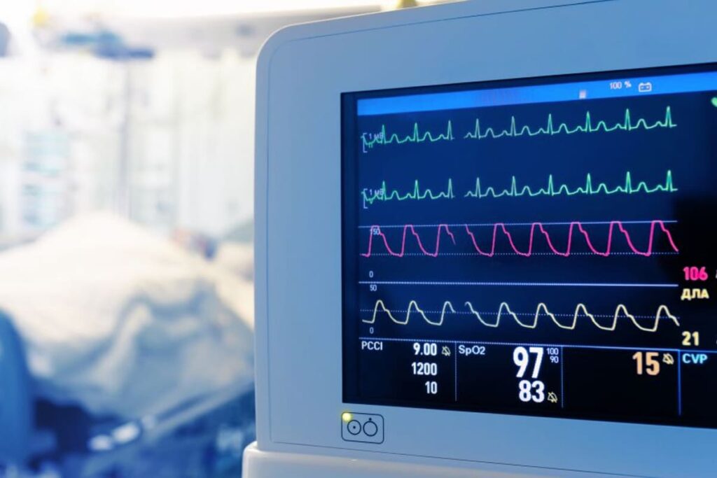 Post-Operative Monitoring